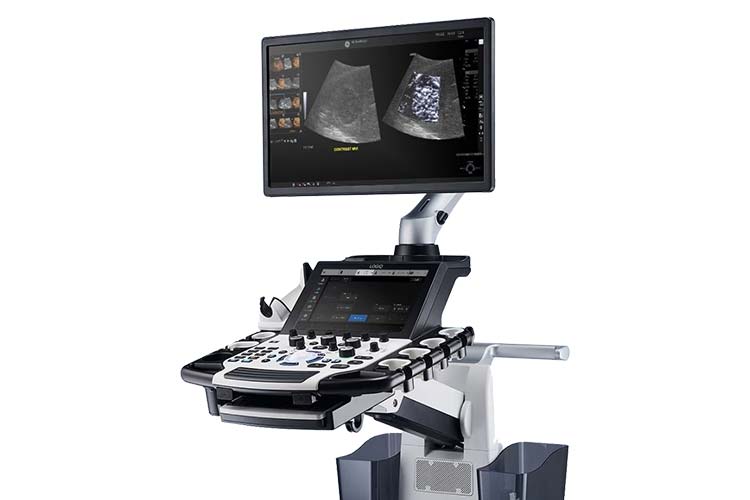 GE LOGIQ Fortis機器画像